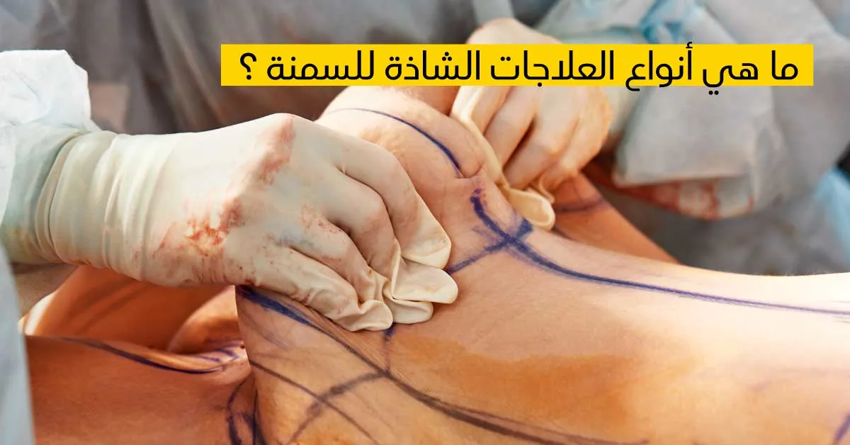 ما هي أنواع العلاجات الشاذة للسمنة ؟